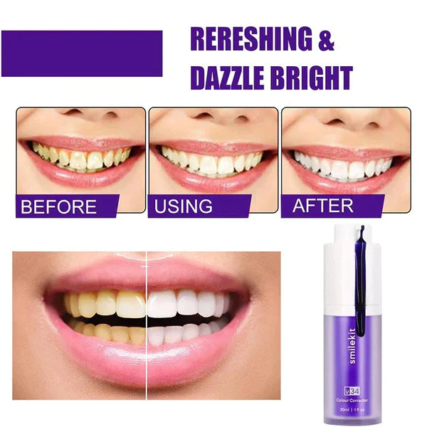 PURPLE V34 - Blanqueador Dental + ENVÍO GRATIS